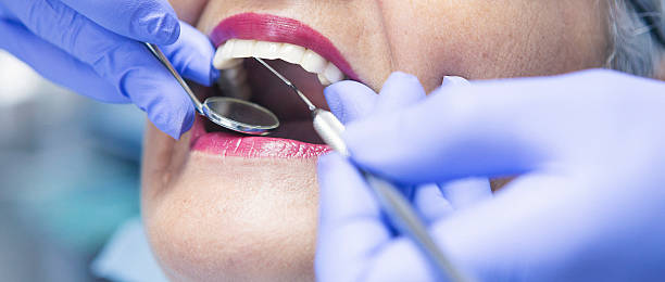 Best Weekend Emergency Dental Services in Parachute, CO